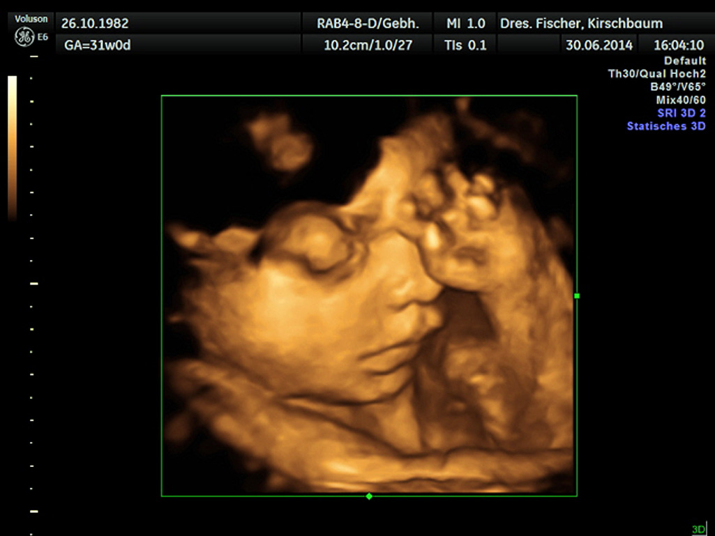3d 4d Ultraschall In Der Schwangerschaft Privatpraxis Dr Fischer Kirschbaum Facharztinnen Fur Frauenheilkunde Und Geburtshilfe